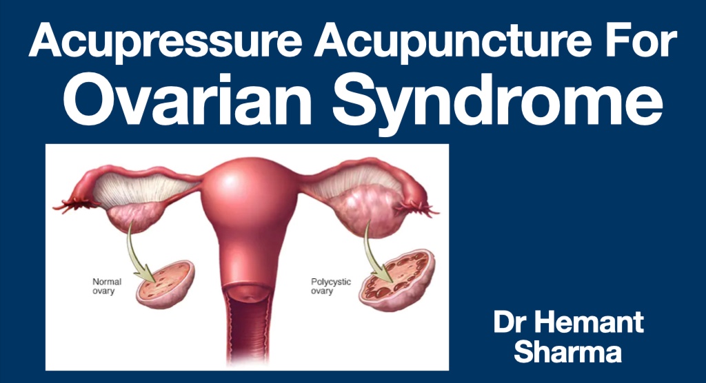 Traditional Acupressure & Acupuncture for Ovarian Disorders cover