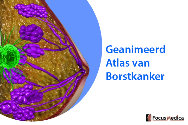 Geanimeerde Atlas van Borstkanker cover