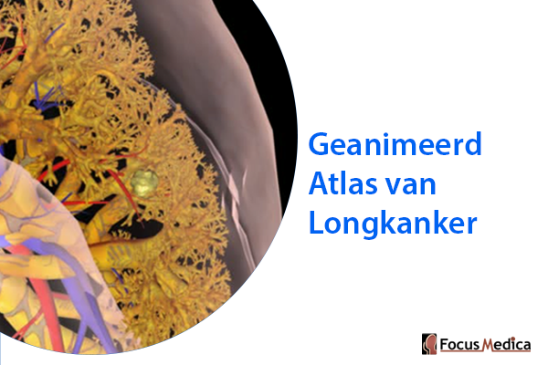 Geanimeerde Atlas van Longkanker cover