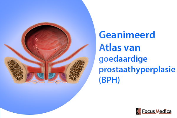Geanimeerde Atlas van goedaardige prostaathyperplasie (BPH) cover