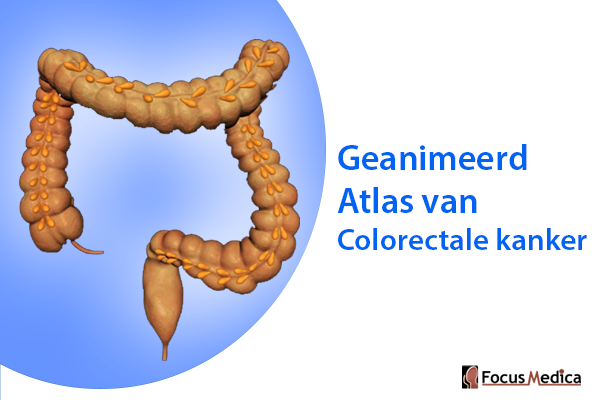 Geanimeerde Atlas van Colorectale kanker cover