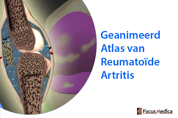 RheumatoidArthritis-dutch cover