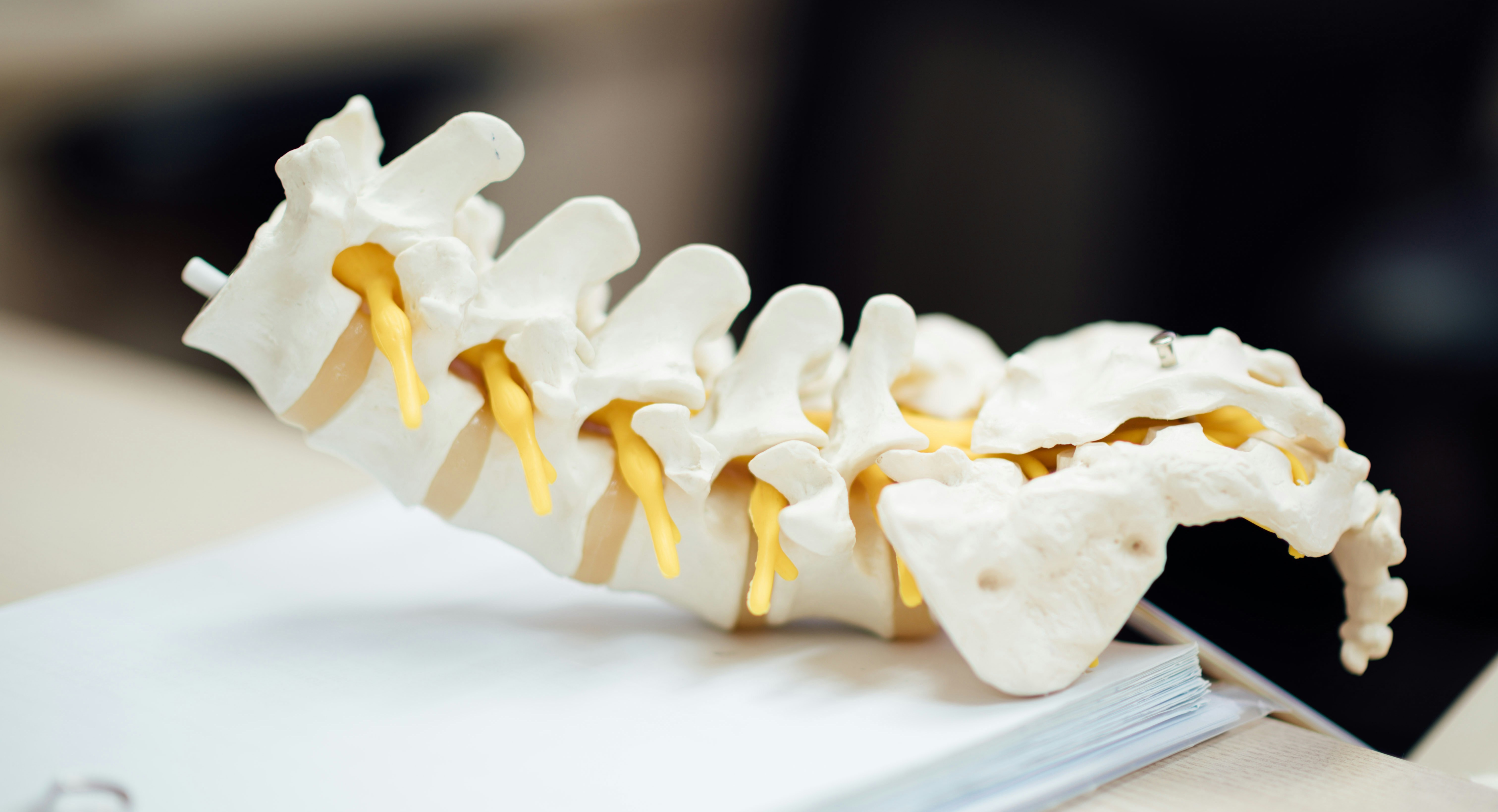 Spine Anatomy ,Pathology & Treatment  cover