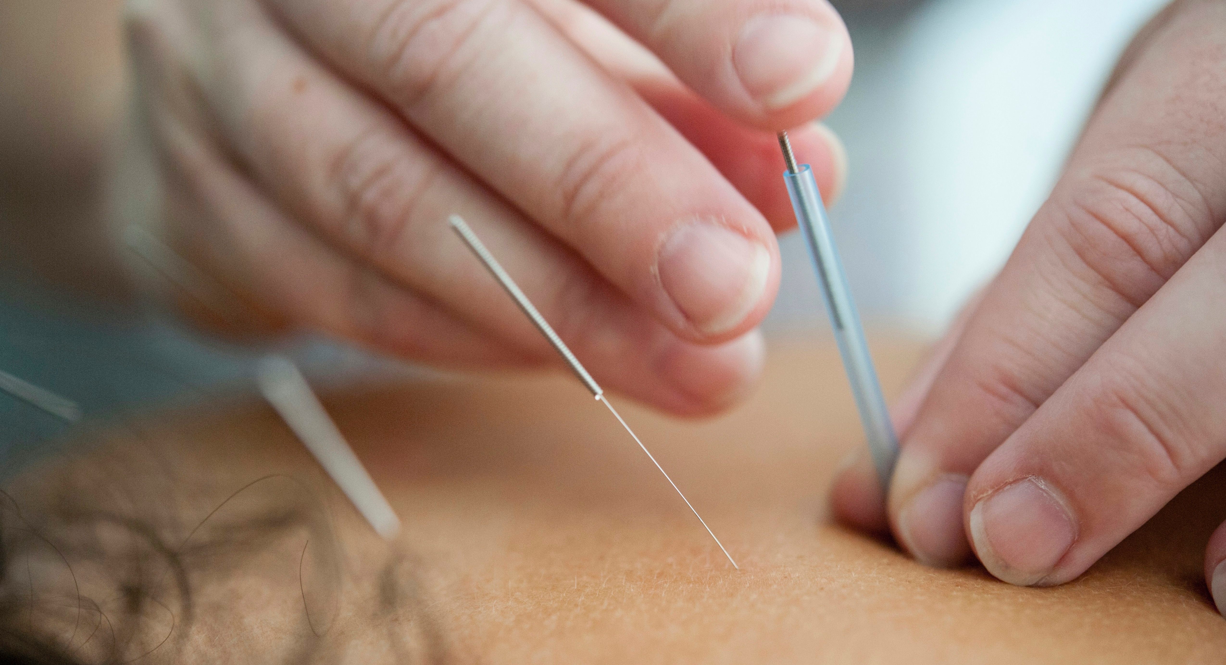 Free Course with Important Videos include Acupuncture &  Marma Therapy  cover