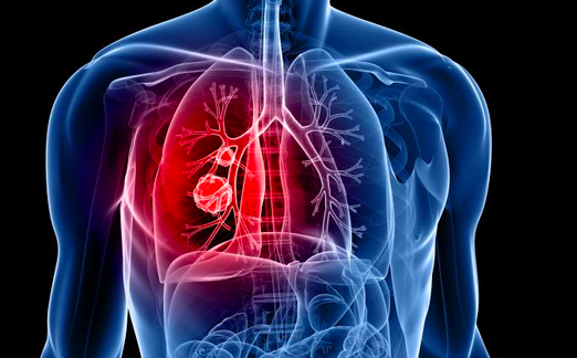 INI SS Pulmonary medicine cover