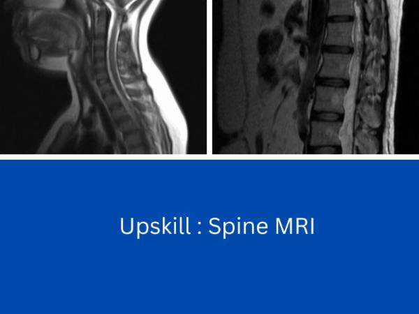 Upskill : Spine MRI cover
