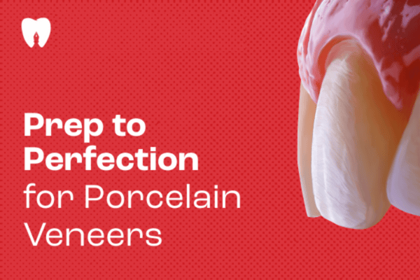 Prep to Perfection for Porcelain Veneers cover
