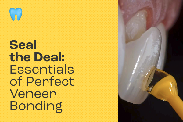 Seal the Deal: Essentials of Perfect Veneer Bonding cover