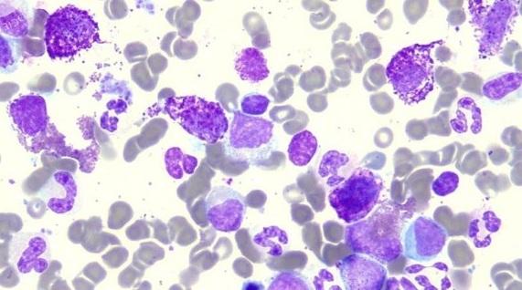 Systemic Mastocytosis cover