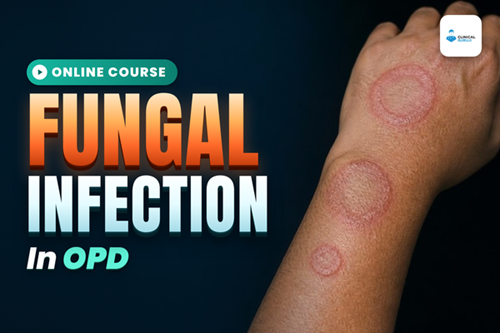 Fungal Infection in OPD cover