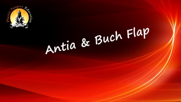 Antia & Buch Flap for Helical reconstruction cover