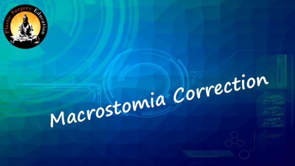 Macrostomia correction cover