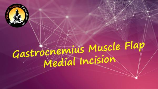 Gastrocnemius Muscle flap : Harvest through Medial incision cover