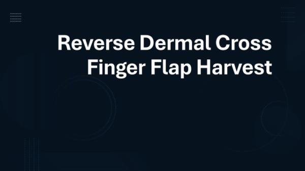 Reverse Dermal Cross Finger Flap cover