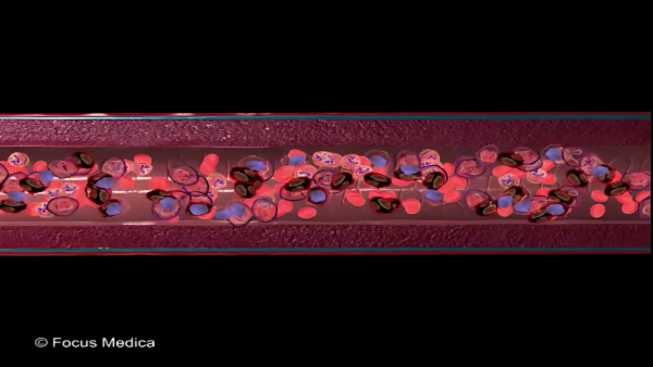 Atlas of Chronic myelogenous leukemia cover