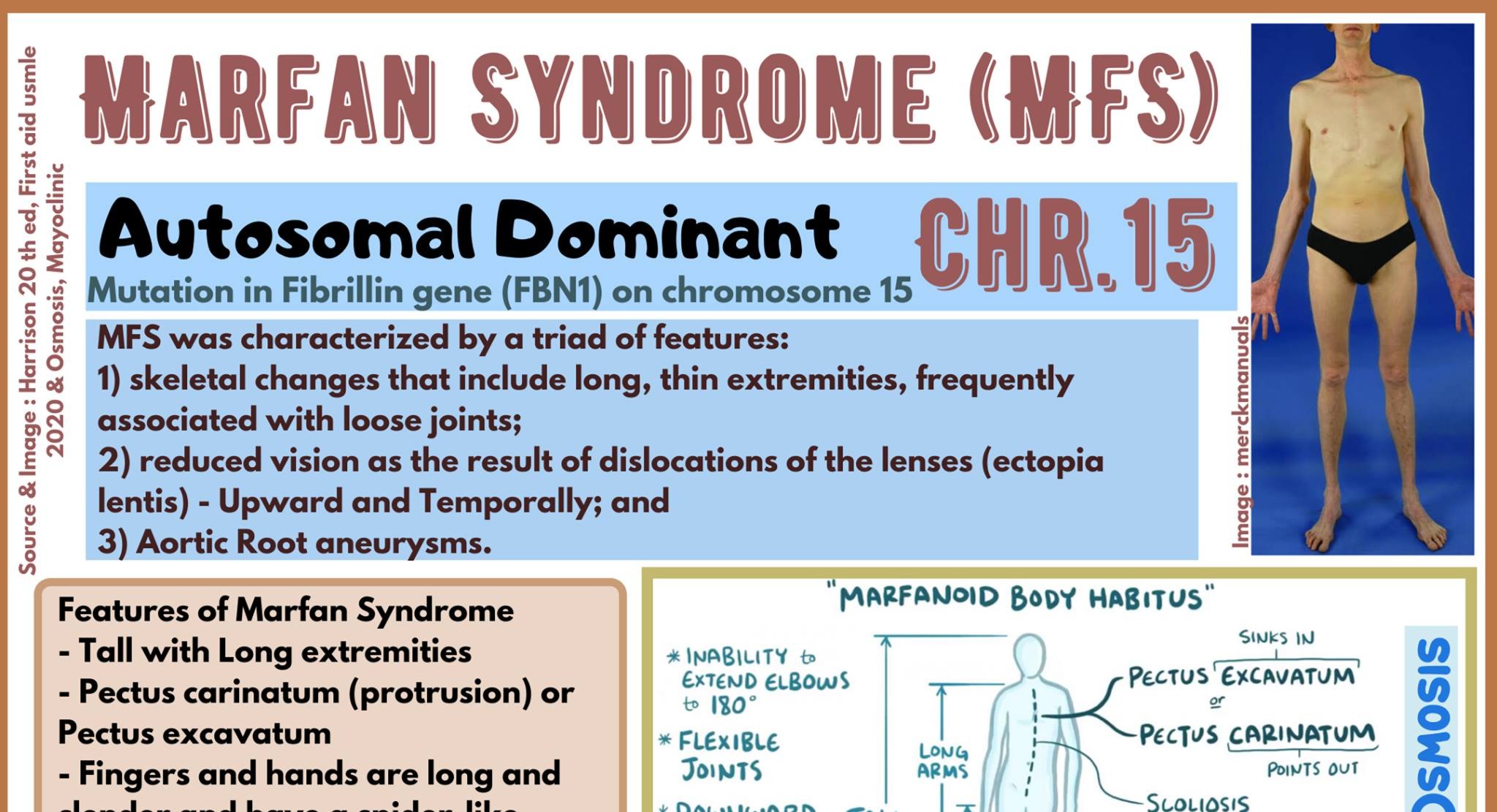 Marfan's Syndrome