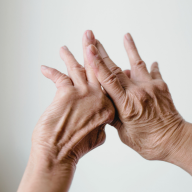 rheumatoid-arthritis 