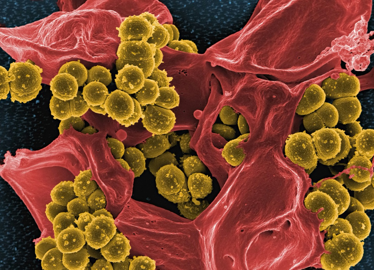 Doctor reviewing infectious disease case and treatment protocol